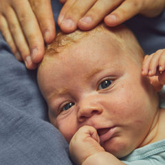 Mustela Cradle Cap Cream 40ml for Baby’s Scalp Care Baby Image