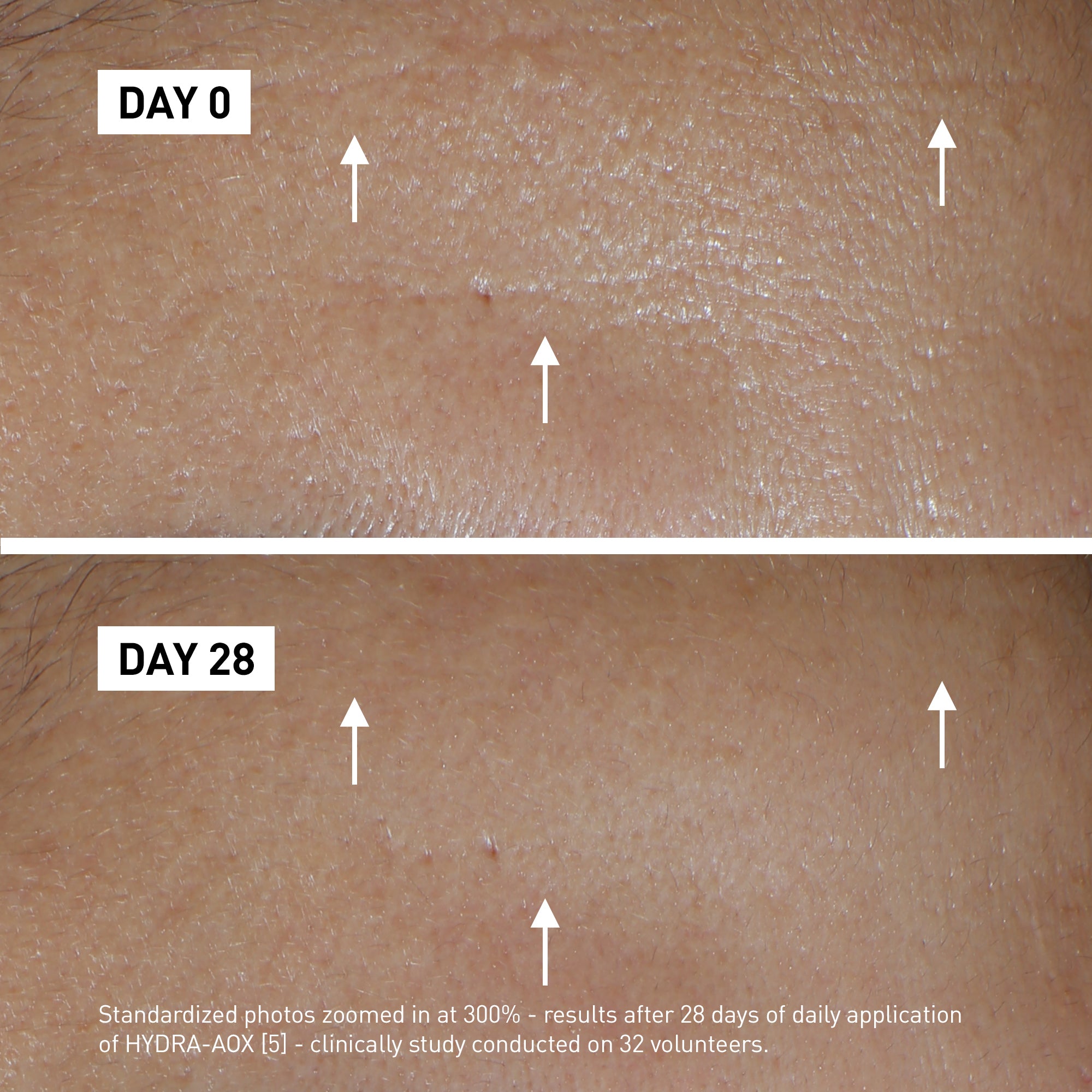 Filorga HYDRA-AOX Product before after image