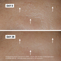 Filorga HYDRA-AOX Product before after image