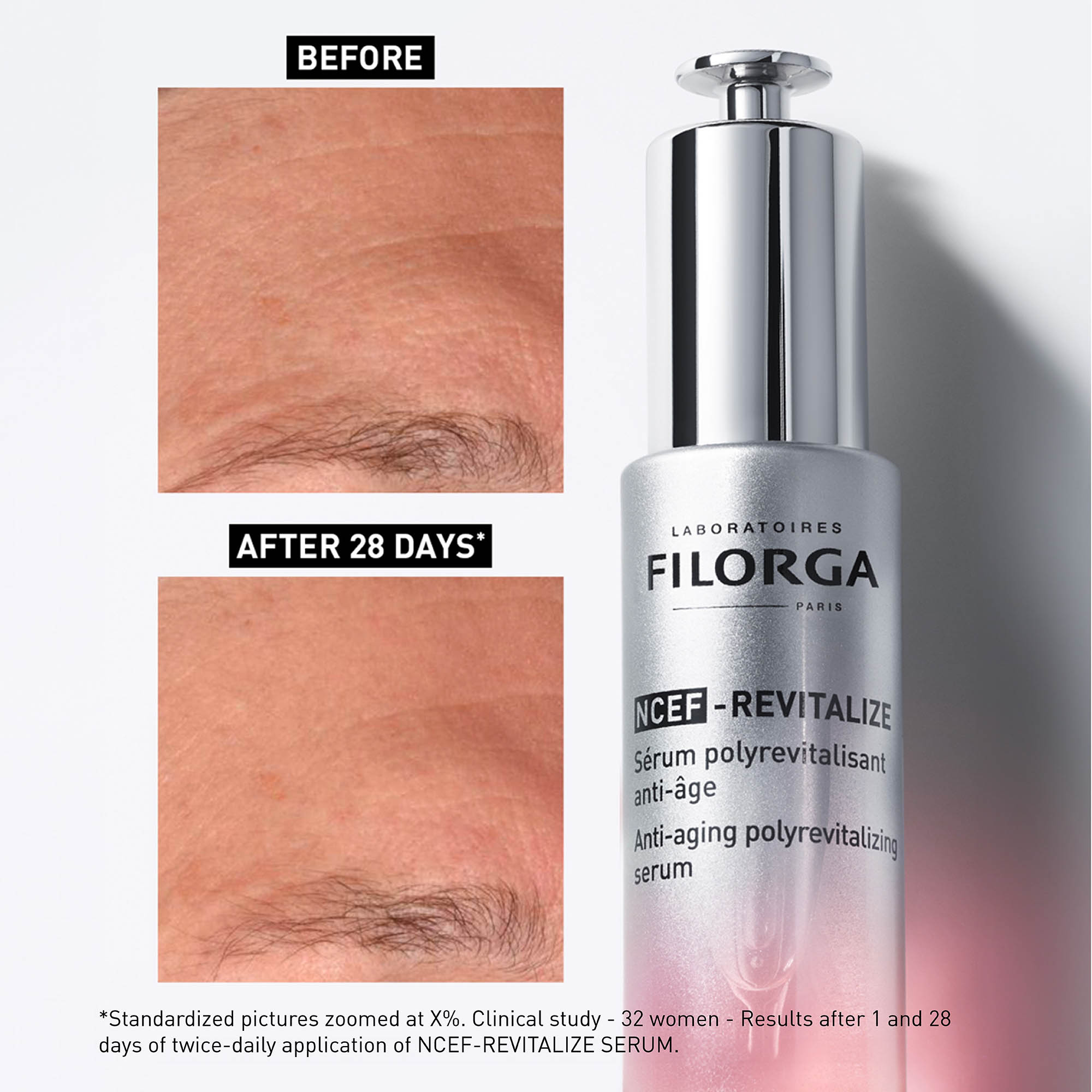 Filorga NCEF-REVITALIZE serum with 'Before' and 'After' skin comparison on a white background