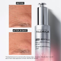 Filorga NCEF-REVITALIZE serum with 'Before' and 'After' skin comparison on a white background