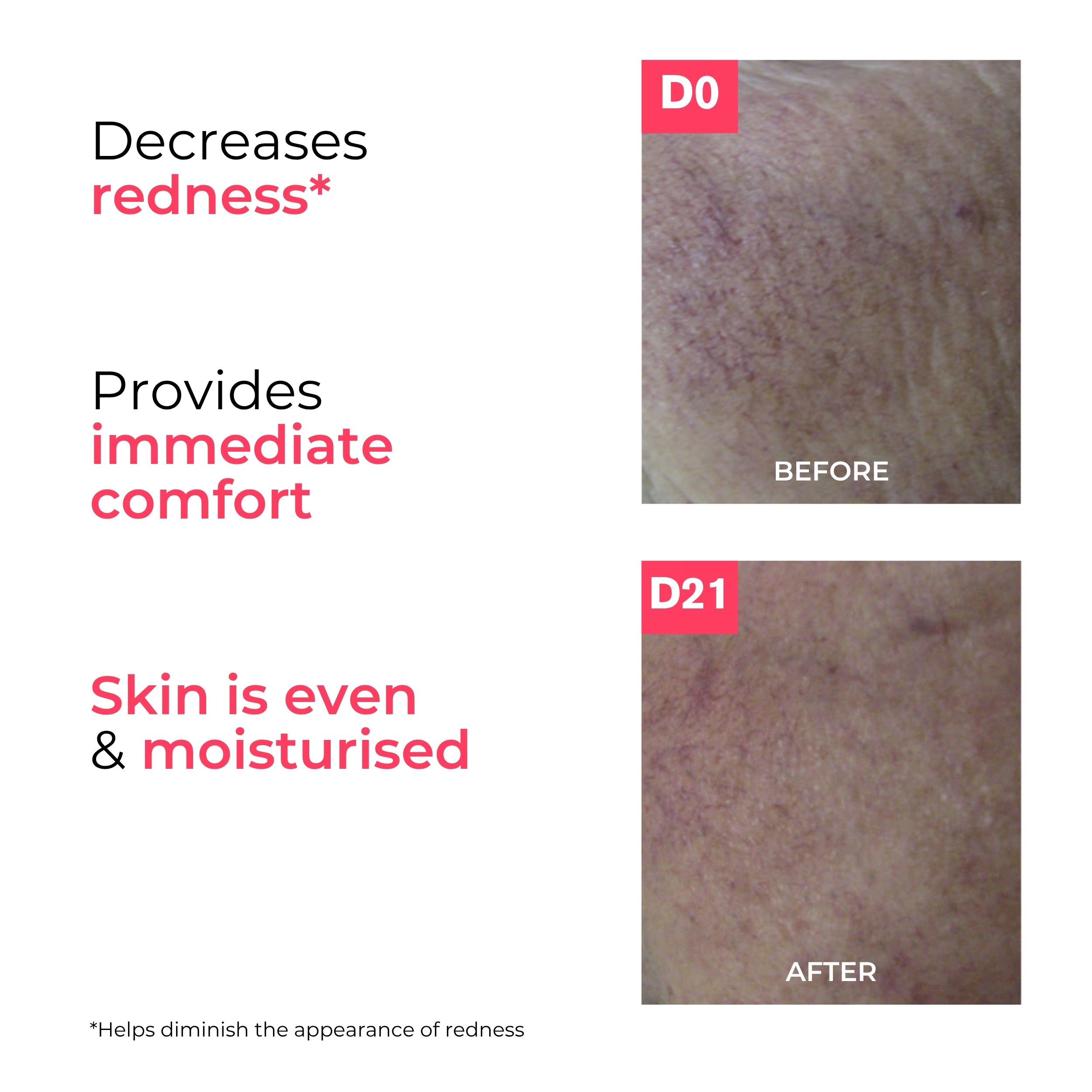 Before and after skin comparison with text indicating product effects on redness and comfort.