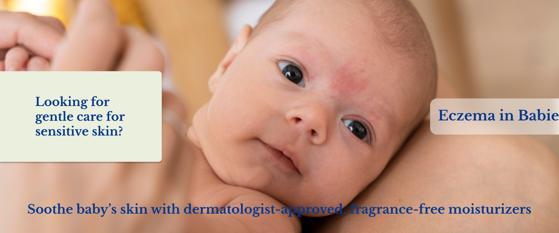 Eczema in Babies: Products That Help Calm Irritated Skin