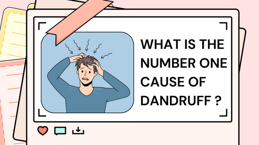 What is the number one cause of dandruff ?