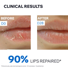 Uriage Bariederm Cica Lips 15ml – Intensive Lip Repair Balm