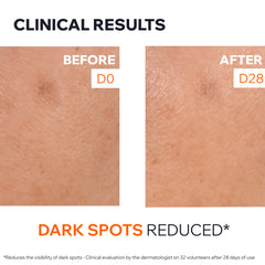 Uriage Depiderm Anti-Brown Spot Brightening Booster 30ml – Dark Spot Corrector Care