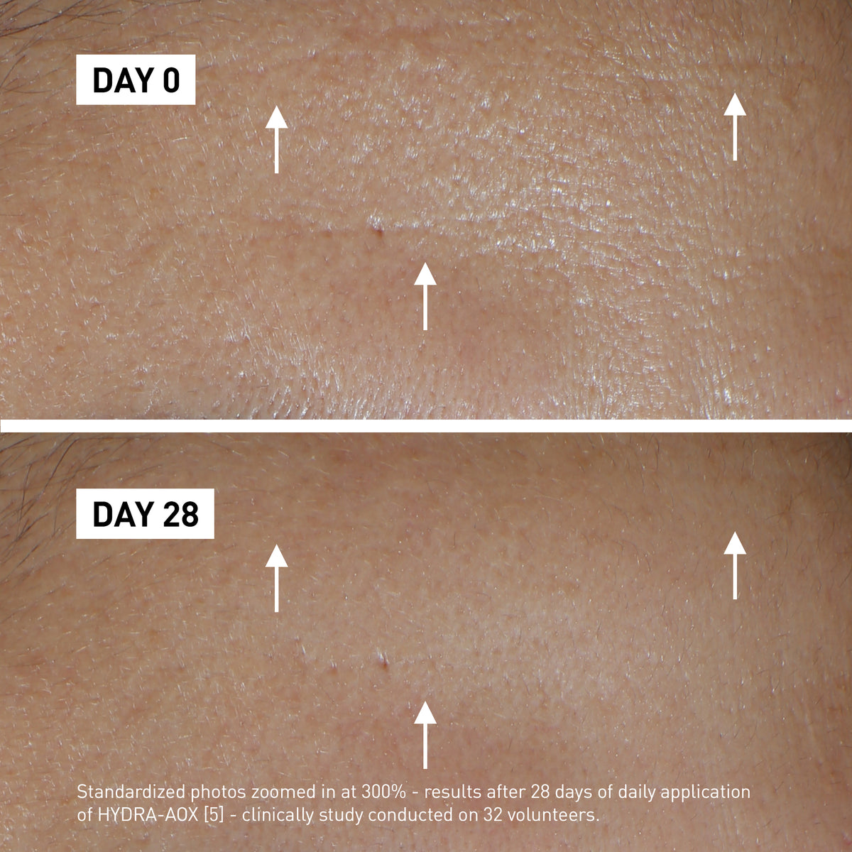 Filorga HYDRA-AOX Product before after image