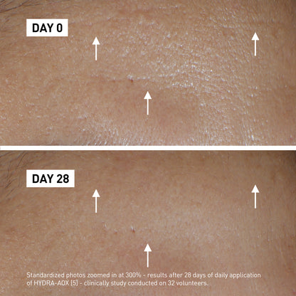 Filorga HYDRA-AOX Product before after image