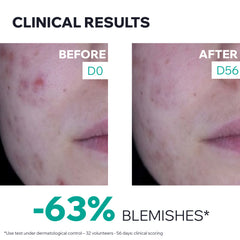 Uriage Hyséac 3-Regul+ Anti-Blemish Care 40ml – Acne Control