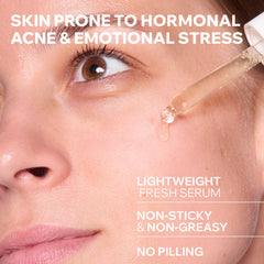 Uriage Hyseac New Skin Serum Anti-blemish Booster 30ml