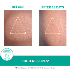 Uriage Hyséac Mattifying Gel-Cream   before and after image 
