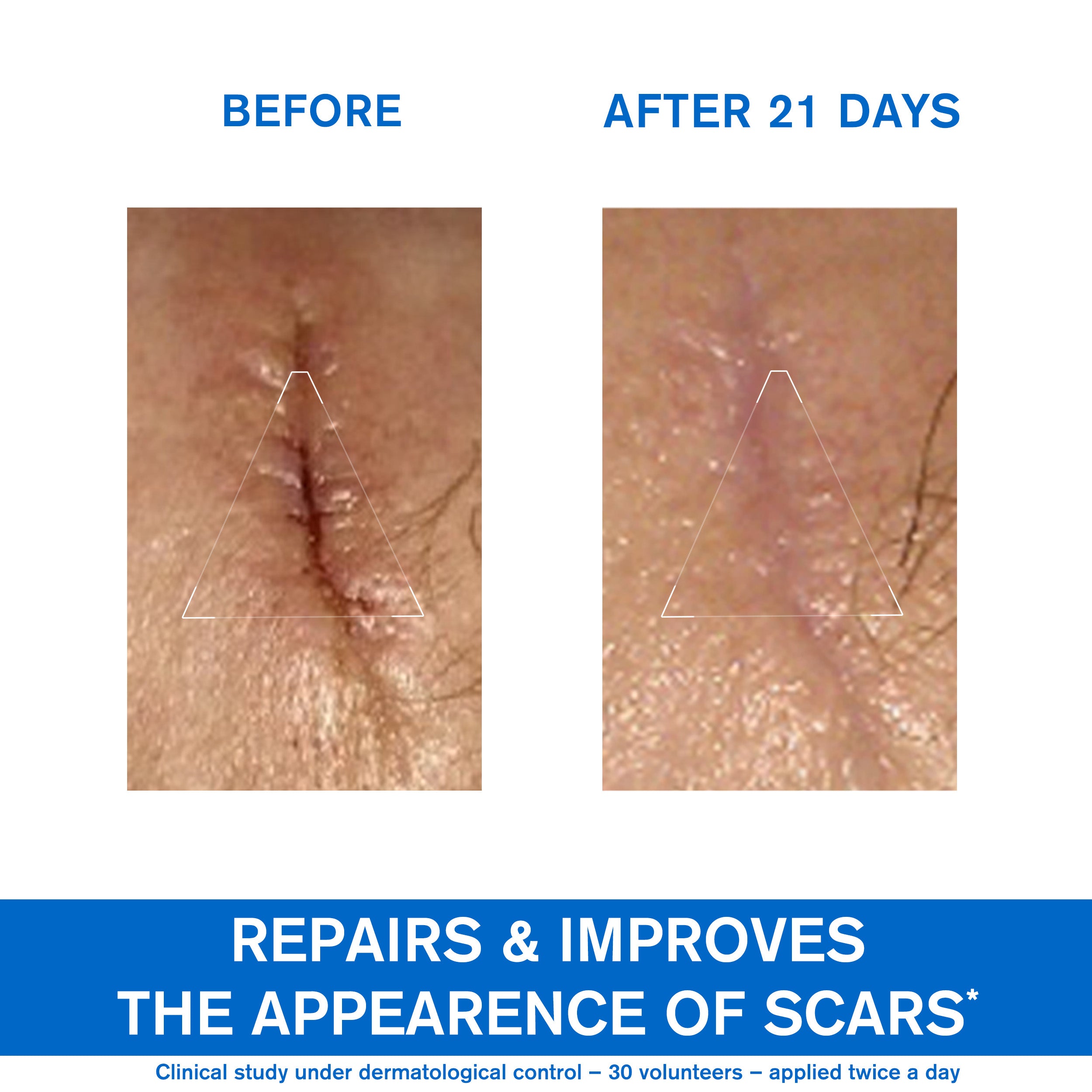 Uriage Bariederm Cica Cream with Copper Zinc