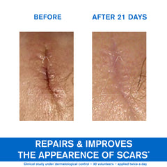 Uriage Bariederm Cica Cream with Copper Zinc before/after 