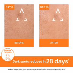 Uriage Depiderm Anti Brown Spot Brightening Booster Results