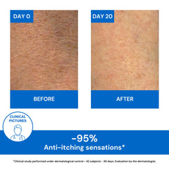 Uriage Xemose C8+ Lipid-Replenishing Anti-Itch Cream 400ml  – Eczema & Dry Skin Care